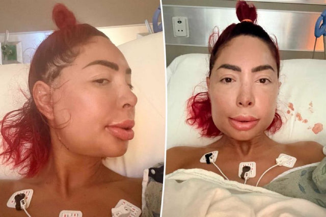 Farrah Abraham new look after jaw surgery