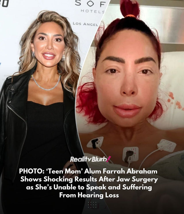 Farrah Abraham jaw surgery recovery swollen face